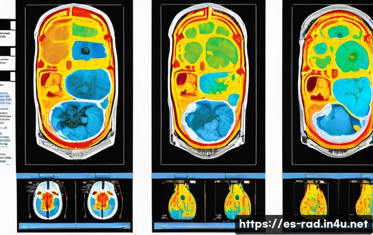 MRI 검사와 방사선 치료의 관계 관련 이미지 2
